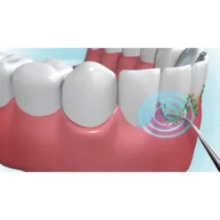 Mediashop DentaPic Sonic - Munddusche -Zahnpflege Verkäufe 850724 3 d 1